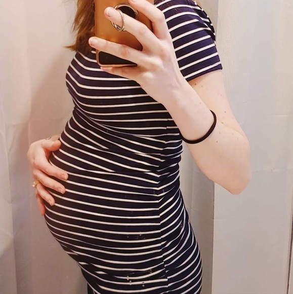 Striped Maternity Dress Bundle - Picture 7 of 7
